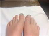 My Toes