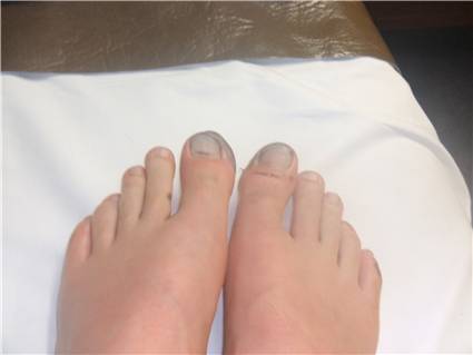 My Toes